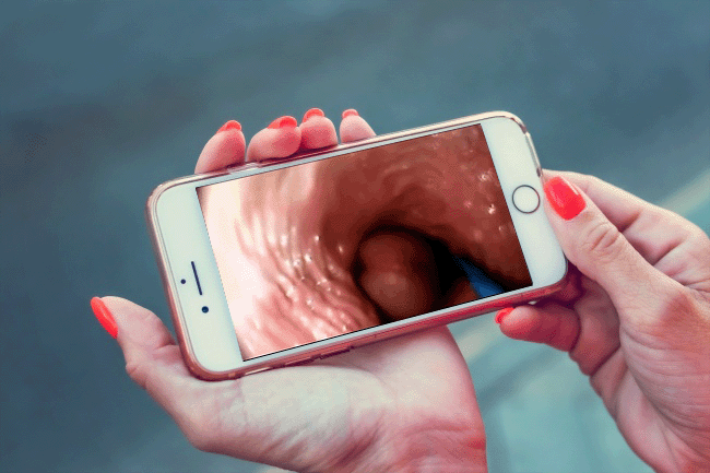 Vagina / Anal Camera - Dual lighted Lenses / Endoscope - Oxy-shop